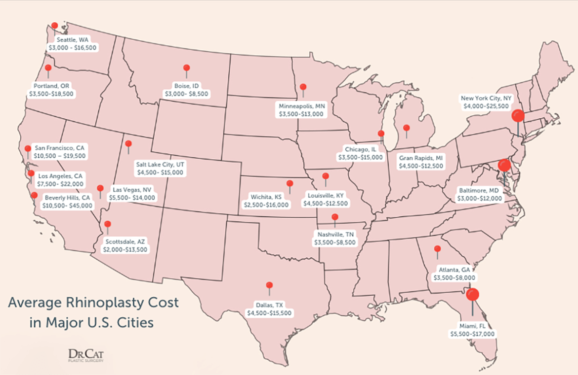 The Average Cost of Rhinoplasty Surgery In Major U.S Cities 