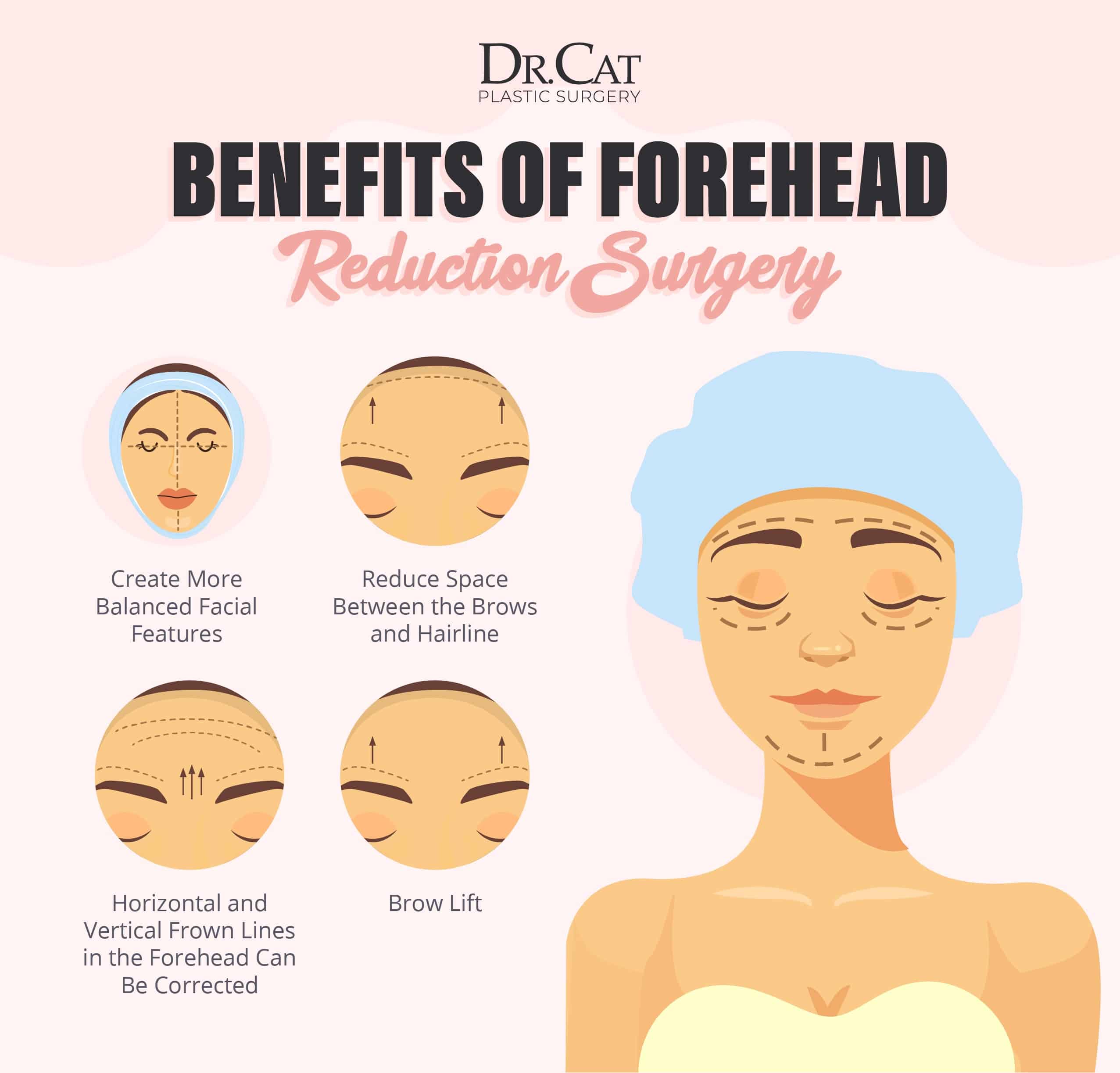Benefits of forehead reduction surgery showing balanced facial proportions