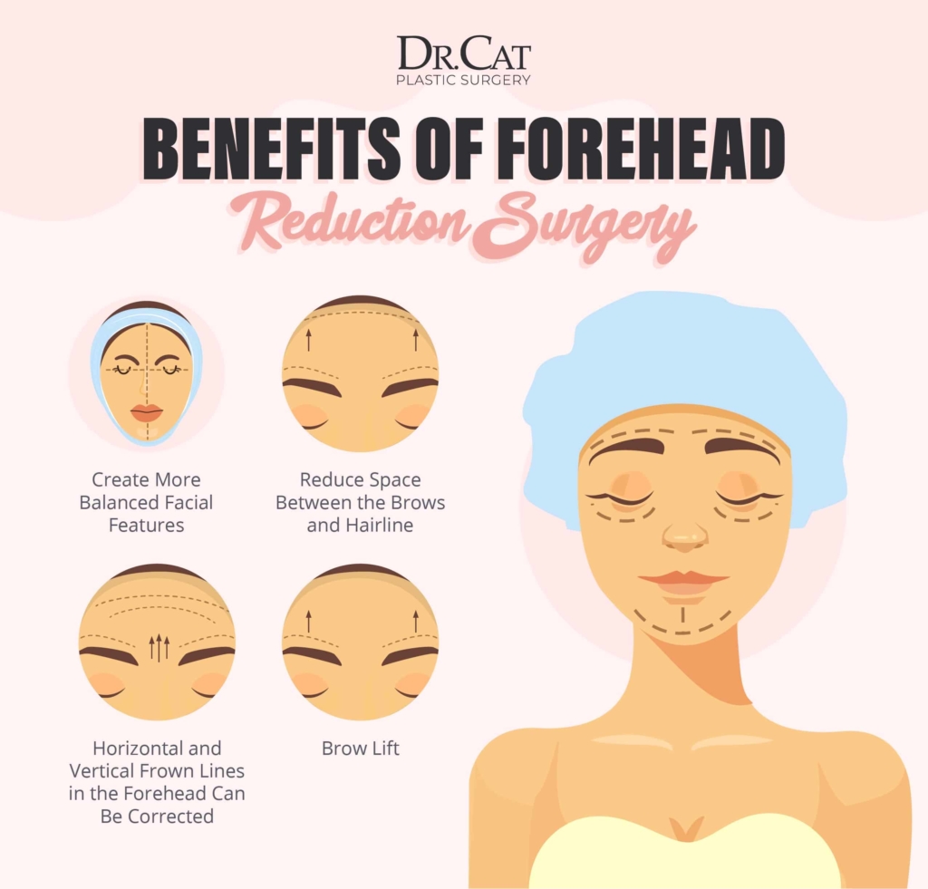 benefits of forehead reduction surgery
