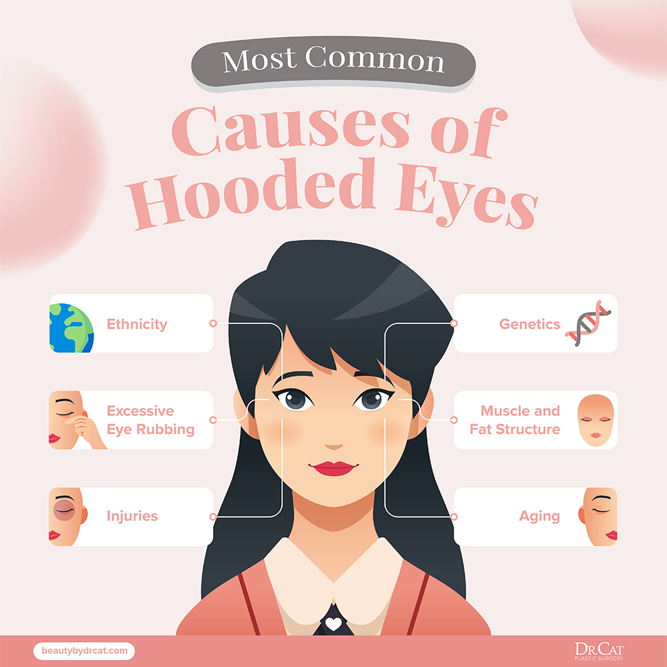 Causes of hooded eyes
