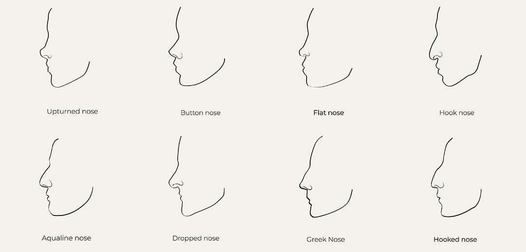 What Is Upturned Nose Rhinoplasy Dr Cat Plastic Surgery