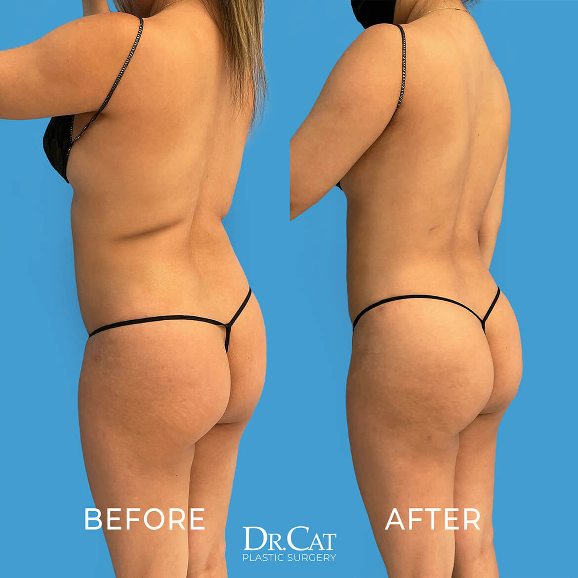BBL Results Before and After