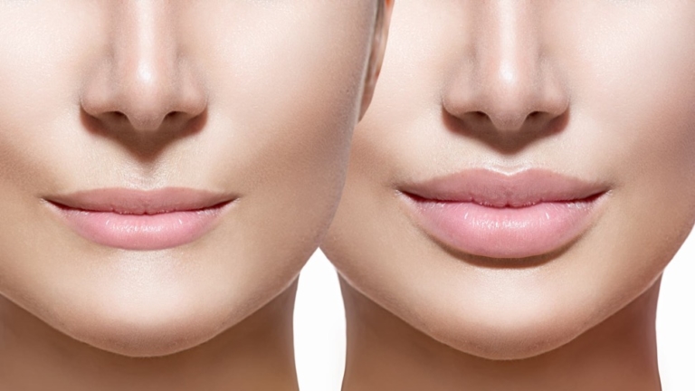 The Plastic Surgery Blog - Dr. Cat Begovic, Beverly Hills